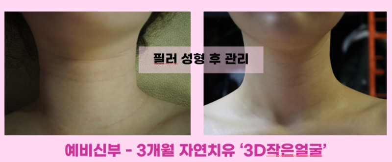 5555555555555.png