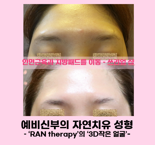 신부의_앞면이마.png