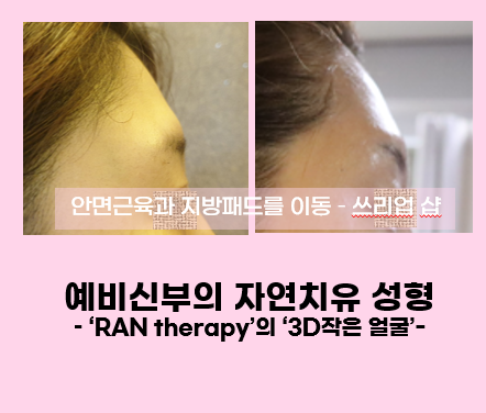 신부_옆이마.png